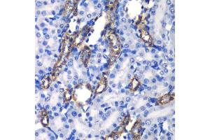 Immunohistochemistry of paraffin-embedded rat kidney using MATK antibody  at dilution of 1:100 (40x lens). (MATK 抗体  (AA 352-466))