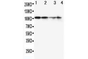 Anti-MCM2 antibody, Western blotting Lane 1: SW620 Cell Lysate Lane 2: PANC Cell Lysate Lane 3: JURKAT Cell Lysate Lane 4: HELA Cell Lysate (MCM2 抗体  (C-Term))