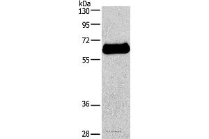 Western blot analysis of HepG2 cell, using IL2RB Polyclonal Antibody at dilution of 1:650 (IL2 Receptor beta 抗体)