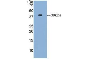 Detection of Recombinant CVL, Human using Polyclonal Antibody to Ezrin (EZR) (Ezrin 抗体  (AA 1-295))
