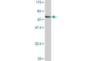 Western Blot detection against Immunogen (73. (ENO1 抗体  (AA 1-434))