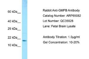 Western Blotting (WB) image for anti-Glia Maturation Factor, beta (GMFB) (Middle Region) antibody (ABIN2790037) (GMFB 抗体  (Middle Region))