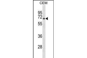 ACCN3 Antibody (N-term) (ABIN1539468 and ABIN2838152) western blot analysis in CEM cell line lysates (35 μg/lane). (ASIC3 抗体  (N-Term))