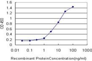 Detection limit for recombinant GST tagged FHL1 is approximately 0. (FHL1 抗体  (AA 23-120))