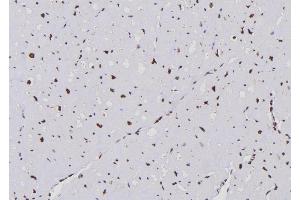 ABIN6259987 and ABIN6276683 at 1/100 staining Human heart tissue by IHC-P. (APOBEC3G 抗体  (C-Term))