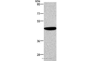 Western blot analysis of Human fetal brain tissue, using ABI1 Polyclonal Antibody at dilution of 1:300 (ABI1 抗体)