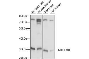 Western blot analysis of extracts of various cell lines, using MTHFSD antibody (ABIN7268486) at 1:1000 dilution. (MTHFSD 抗体  (AA 1-383))