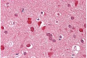 Image no. 2 for anti-Zinc Finger, FYVE Domain Containing 1 (ZFYVE1) (AA 650-699) antibody (ABIN6749748) (ZFYVE1 抗体  (AA 650-699))