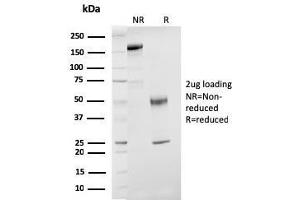 SDS-PAGE Analysis Purified ER-beta Mouse Monoclonal Antibody (ESR2/3207). (ESR2 抗体)
