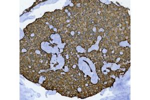 IHC analysis of GLB1/Beta-galactosidase using anti-GLB1/Beta-galactosidase antibody (ABIN7601806). (GLB1 抗体  (AA 46-655))