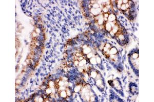 Immunohistochemistry (IHC) image for anti-Peroxiredoxin 3 (PRDX3) (AA 239-256), (C-Term) antibody (ABIN3044200)