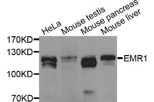 Western blot analysis of Jurkat cell lysate using EMR1 antibody. (F4/80 抗体  (AA 21-290))