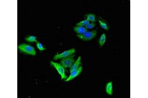 Immunofluorescence (IF) image for anti-gamma-aminobutyric Acid (GABA) A Receptor, beta 3 (GABRB3) (AA 328-450) antibody (ABIN7153497)