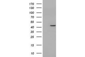 HEK293T cells were transfected with the pCMV6-ENTRY control (Left lane) or pCMV6-ENTRY CBWD1 (Right lane) cDNA for 48 hrs and lysed. (CBWD1 抗体)