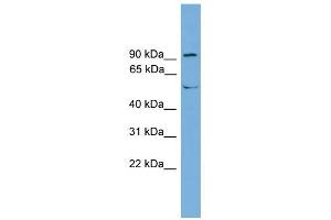 TEC antibody used at 1 ug/ml to detect target protein. (NR4A3 抗体  (Middle Region))