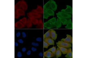 ABIN6266262 and ABIN6277409 staining Hela cells(30 min of UV treatment) by IF/ICC. (POMC 抗体  (C-Term))
