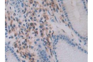 IHC-P analysis of Human Stomach Tissue, with DAB staining. (Chemerin 抗体  (AA 33-158))