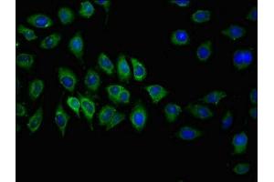 Immunofluorescent analysis of A549 cells using ABIN7146636 at dilution of 1:100 and Alexa Fluor 488-congugated AffiniPure Goat Anti-Rabbit IgG(H+L) (ABCC2 抗体  (AA 724-947))