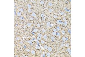 Immunohistochemistry (IHC) image for anti-Solute Carrier Family 1 (Glial High Affinity Glutamate Transporter), Member 3 (SLC1A3) antibody (ABIN7270394)