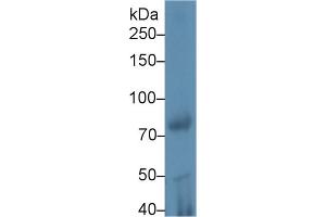 Western Blot; Sample: Rat Testis lysate; Primary Ab: 1µg/ml Rabbit Anti-Mouse iPLA2 Antibody Second Ab: 0. (PLA2G6 抗体  (AA 481-702))