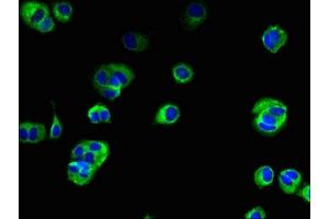 Immunofluorescent analysis of MCF-7 cells using ABIN7173155 at dilution of 1:100 and Alexa Fluor 488-congugated AffiniPure Goat Anti-Rabbit IgG(H+L) (TMEM222 抗体  (AA 77-164))
