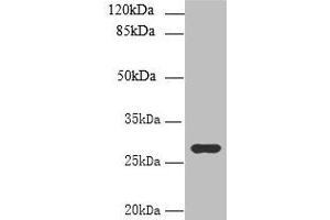 Western blot All lanes: UTP23 antibody at 7 μg/mL + Mouse liver tissue Secondary Goat polyclonal to rabbit IgG at 1/10000 dilution Predicted band size: 29, 17 kDa Observed band size: 29 kDa (UTP23 抗体  (AA 1-249))