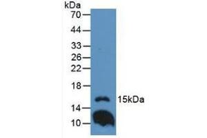 Western blot analysis of Mouse Lung Tissue. (IL1F9 抗体  (AA 5-149))