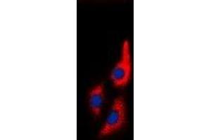 Immunofluorescent analysis of MYL9 staining in Jurkat cells. (MYL9 抗体  (N-Term))