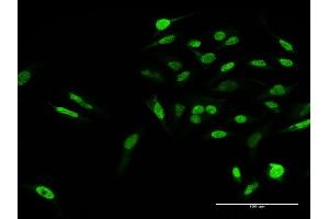 Immunofluorescence of purified MaxPab antibody to KLF15 on HeLa cell. (KLF15 抗体  (AA 1-416))