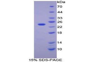 SDS-PAGE analysis of Mouse Carbonic Anhydrase I Protein. (CA1 蛋白)