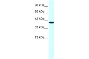 Western Blotting (WB) image for anti-H6 Family Homeobox 1 (HMX1) antibody (ABIN2460518) (HMX1 抗体)