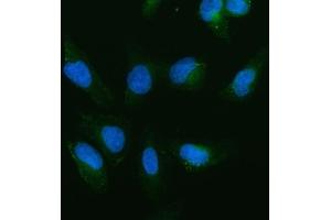 IF analysis of cIAP1/BIRC2 using anti-cIAP1/BIRC2 antibody (ABIN5693185). (BIRC2 抗体  (AA 320-570))
