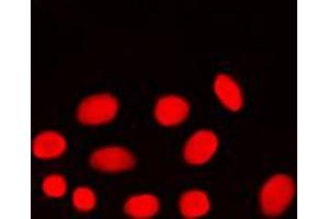 Immunofluorescent analysis of ADA2A staining in MCF7 cells. (TADA2L 抗体  (Center))