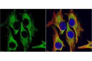 ICC/IF Image HSD11B1 antibody detects HSD11B1 protein at cytoplasm by immunofluorescent analysis. (HSD11B1 抗体  (C-Term))