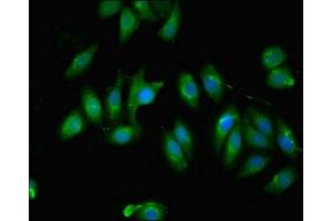 Immunofluorescent analysis of A549 cells using ABIN7174731 at dilution of 1:100 and Alexa Fluor 488-congugated AffiniPure Goat Anti-Rabbit IgG(H+L) (PARP11 抗体  (AA 1-245))