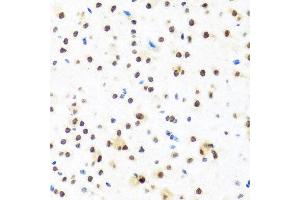Immunohistochemistry of paraffin-embedded mouse brain using FUBP1 antibody at dilution of 1:100 (x40 lens).