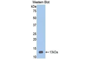 Detection of Recombinant HPA, Human using Polyclonal Antibody to Heparanase (HPSE) (HPSE 抗体  (AA 34-115))