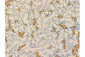 ABIN6263517 and ABIN6266843 at 1/100 staining Rat kidney tissue by IHC-P. (NAA15 抗体  (Internal Region))