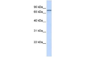 Western Blotting (WB) image for anti-ADAM Metallopeptidase Domain 15 (ADAM15) antibody (ABIN2459014) (ADAM15 抗体)