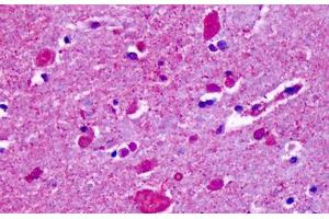 Anti-CELSR2 antibody IHC staining of human brain, cortex, cerebellum. (CELSR2 抗体  (N-Term))