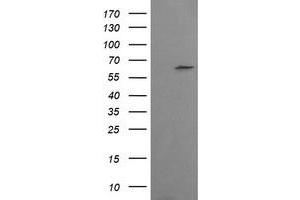 Image no. 1 for anti-Chaperonin Containing TCP1, Subunit 8 (Theta)-Like 2 (CCT8L2) antibody (ABIN1497481) (CCT8L2 抗体)