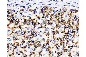 Immunohistochemistry analysis of paraffin-embedded Rat stomach using Catenin beta Monoclonal Antibody at dilution of 1:200. (beta Catenin 抗体)