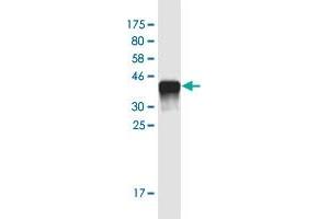 Western Blot detection against Immunogen (36. (NUT (AA 1033-1132) 抗体)