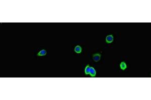 Immunofluorescent analysis of HepG2 cells using ABIN7170309 at dilution of 1:100 and Alexa Fluor 488-congugated AffiniPure Goat Anti-Rabbit IgG(H+L) (SSTR2 抗体  (AA 304-369))
