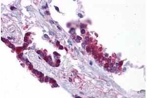 Immunohistochemistry (Formalin-fixed Paraffin-embedded Sections) (IHC (fp)) image for anti-Kruppel-Like Factor 2 (Lung) (KLF2) (AA 216-265) antibody (ABIN574495)