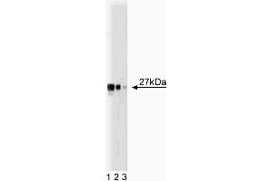 Western blot analysis of Drp1 on a HCT-8 cell lysate (Human colorectal adenocarcinoma, ATCC CCL-244). (Dynamin 1-Like 抗体  (AA 19-201))