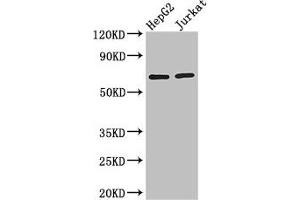 Western Blot Positive WB detected in: HepG2 whole cell lysate, Jurkat whole cell lysate All lanes: RUNX1T1 antibody at 2. (RUNX1T1 抗体  (AA 416-525))
