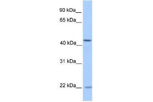 ZNF485 antibody used at 0. (ZNF485 抗体  (N-Term))