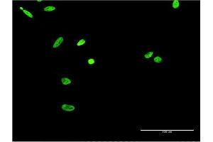 Immunofluorescence of monoclonal antibody to EWSR1 on HeLa cell. (EWSR1 抗体  (AA 358-453))