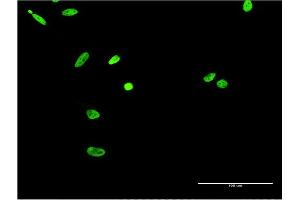 Immunofluorescence of monoclonal antibody to EWSR1 on HeLa cell.